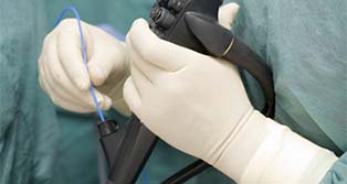 آنچه که باید درباره ERCP بدانید