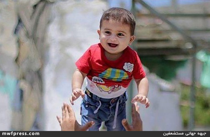 کودک شیرخوار غزه یکسال بعد از معجزه/عکس