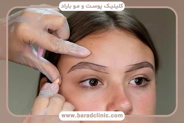 روش های نوین کاشت ابرو ، آنچه پیش از کاشت باید بدانید روش های نوین کاشت ابرو ، آنچه پیش از کاشت باید بدانید