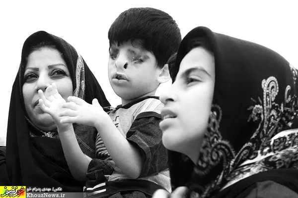 حامد احساساتش را با خندیدن و تکان دادن دست و پایش نشان می دهد و هنگام ناراحتی یا نیاز به چیزی، با فریاد و زدن مادرش حس خود را بروز می دهد.